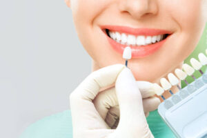 close up portrait of Young women with veneers