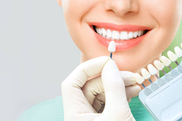 close up portrait of Young women with veneers