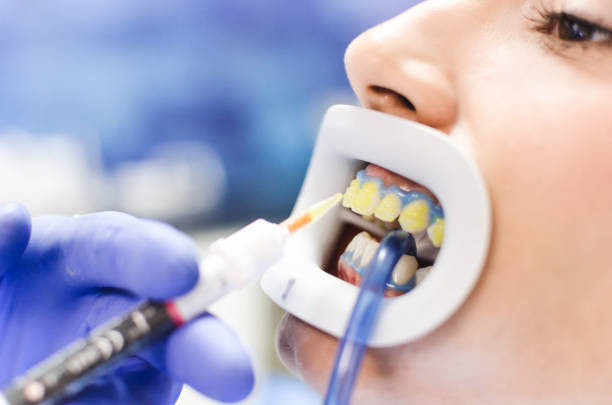 young woman on teeth whitening treatment at dentist.