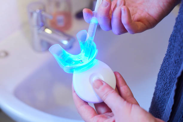a phot showing a person applying the teeth whitening gel to the mouthpiece from a syringe