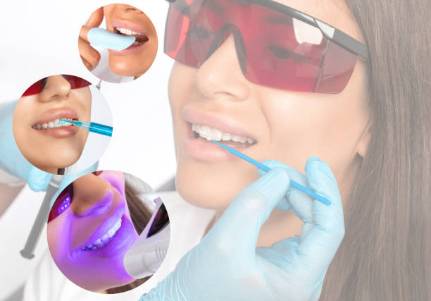  a photo showing a woman during a teeth whitening treatment
