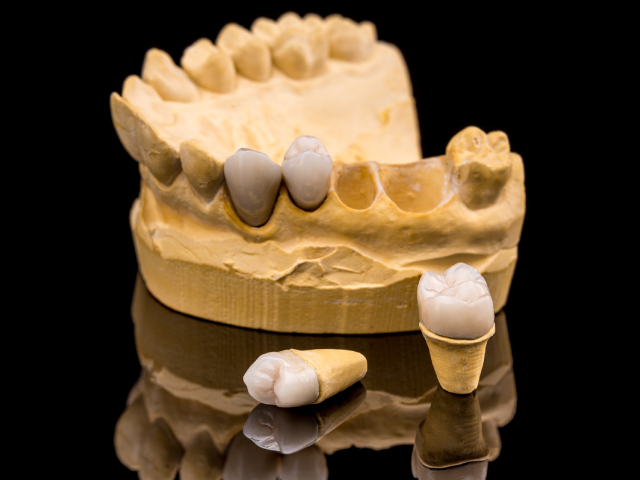 Oral Surgery