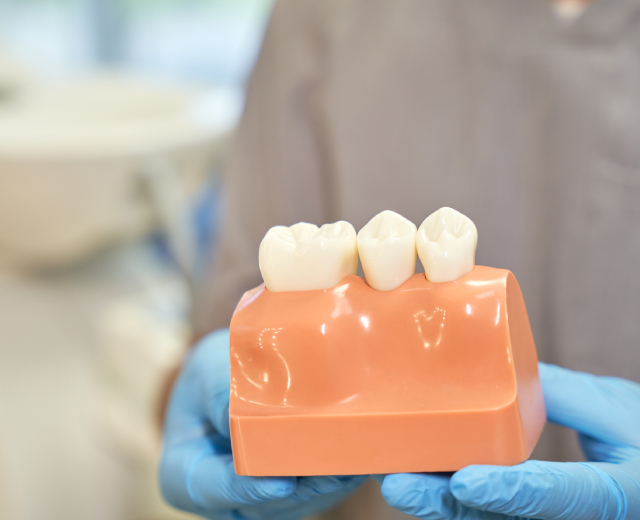 Dental Crowns