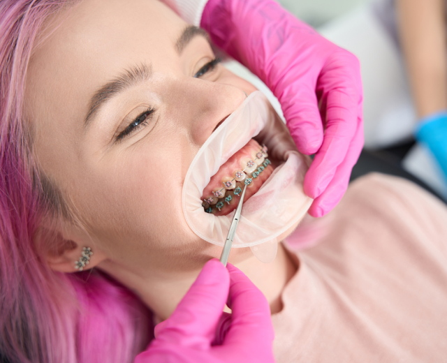 Orthodontic Options