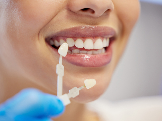 Cosmetic Dentistry