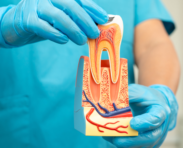 Root Canal Therapy