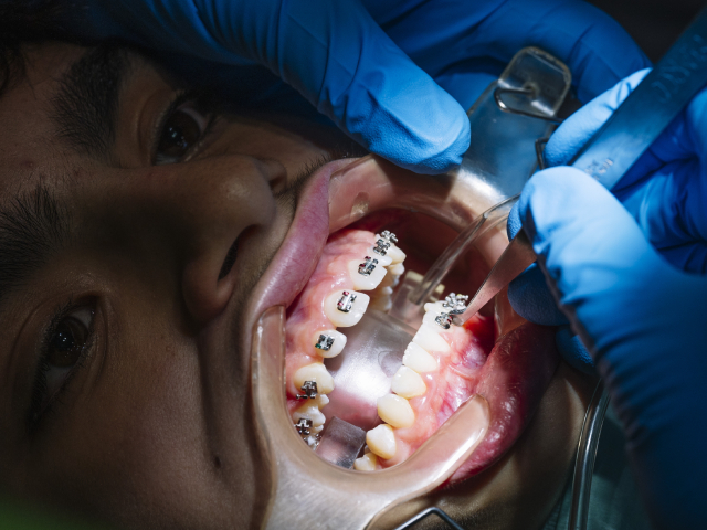 What Is Oral Surgery