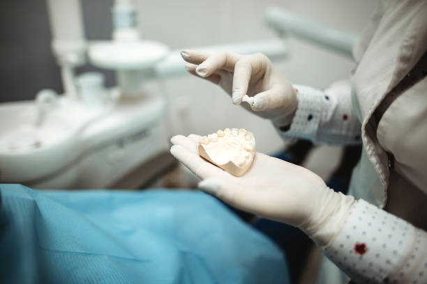 dental impressions on a dentist's hand