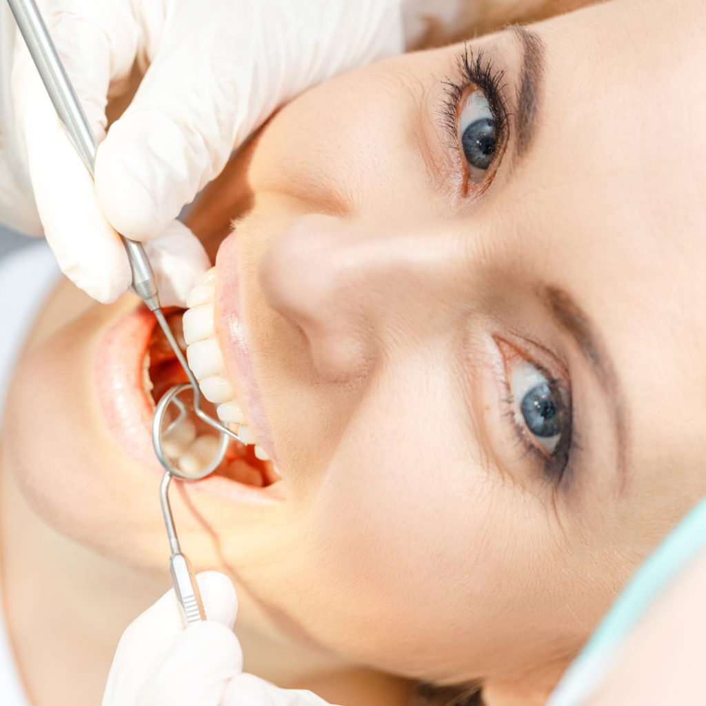 Signs You May Need a Deep Cleaning