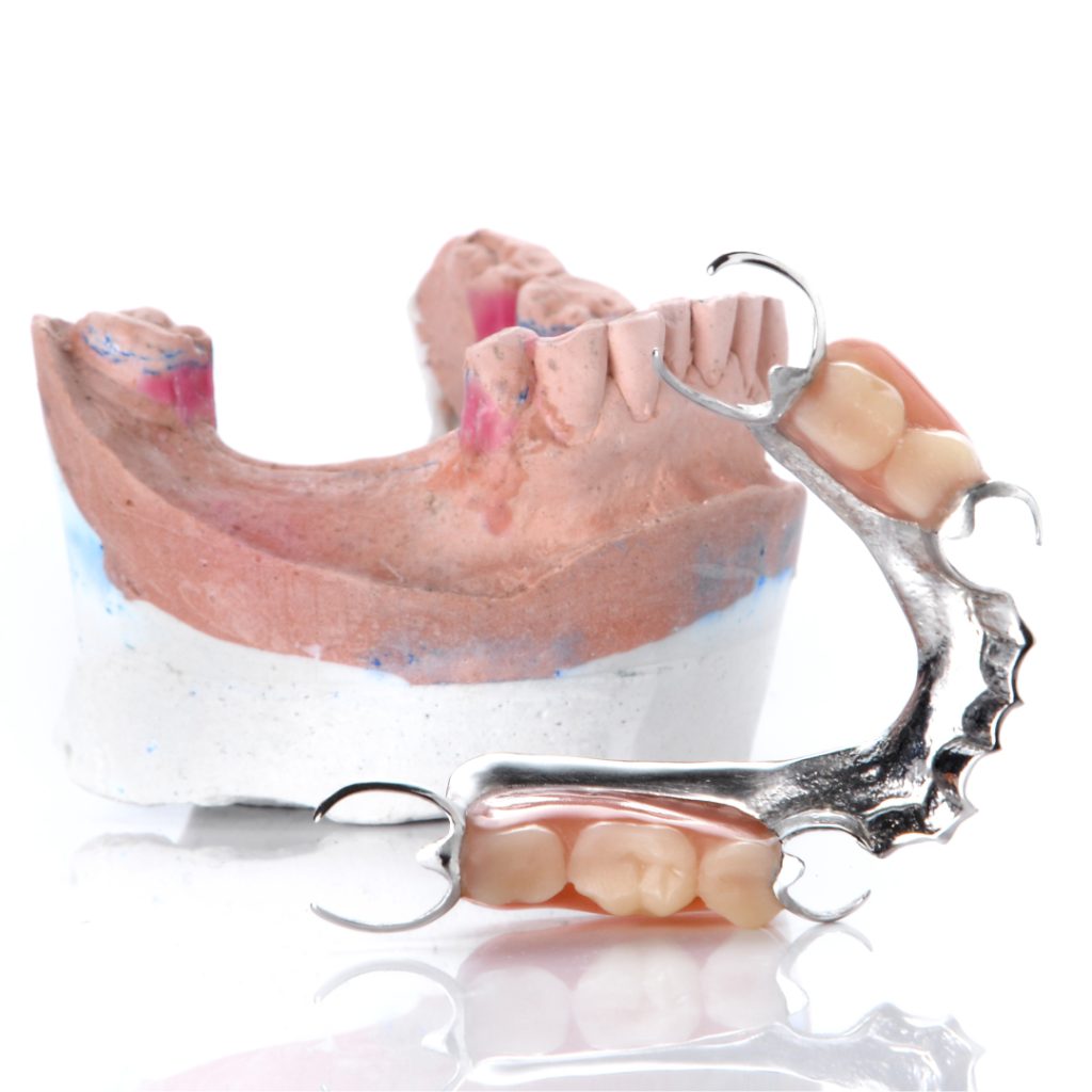 What Are Partial Dentures