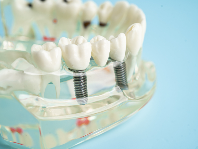 Why Choose Vivid Dental of Raleigh (4)