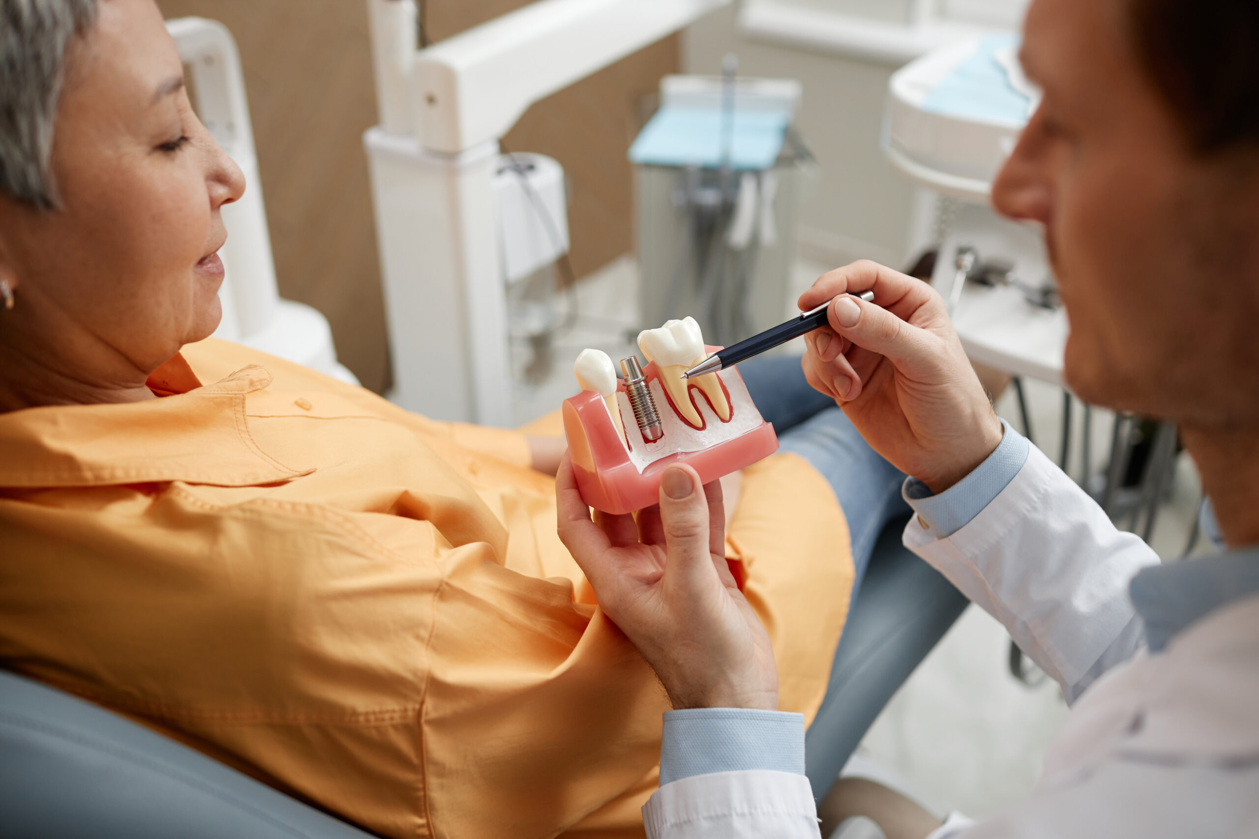 full-arch-implant-replacement