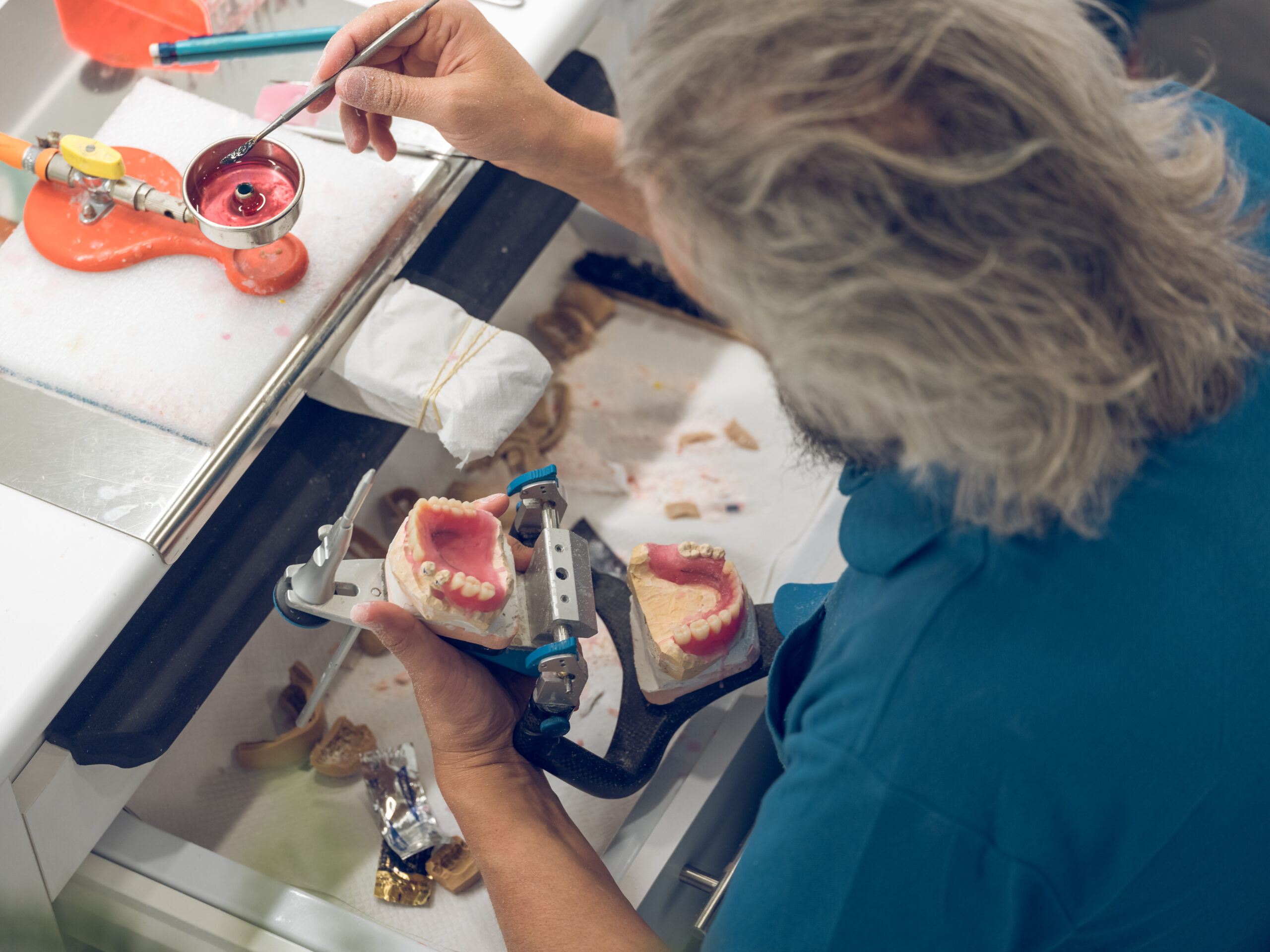 medicaid-denture-fabrication