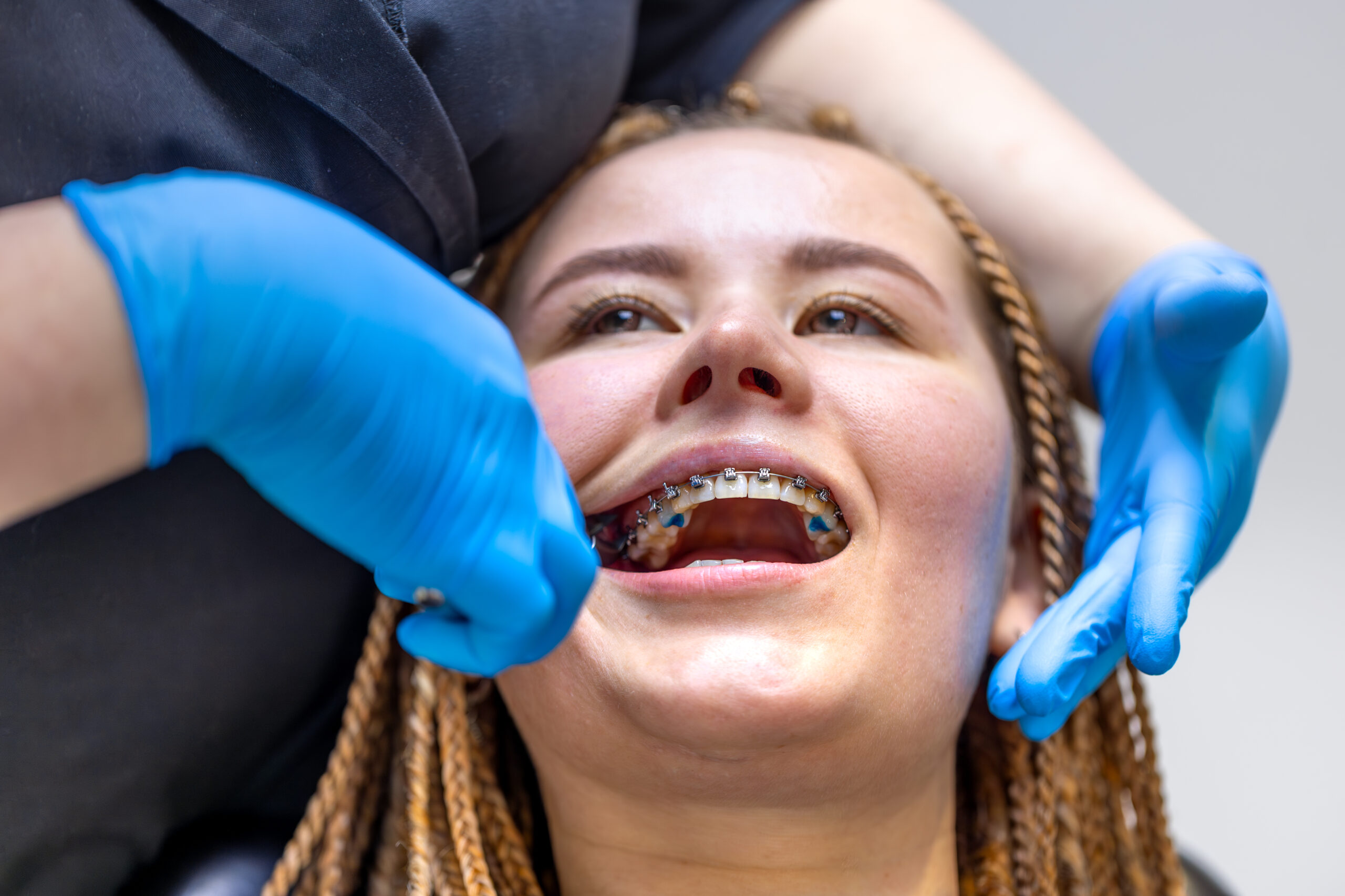 braces-consultation